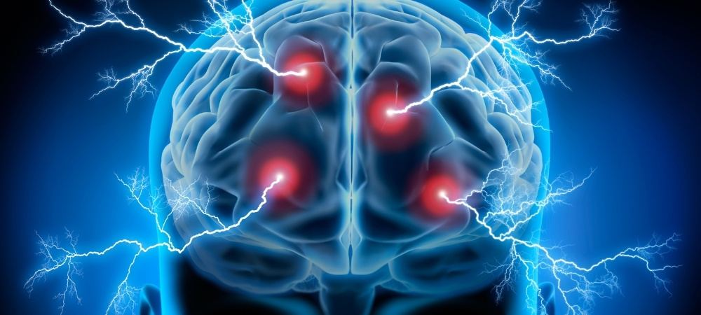 Illustration of a human brain with four glowing red areas, struck by blue lightning bolts against a dark blue background