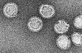 Electron micrograph of several round virus particles against a grey, grainy background